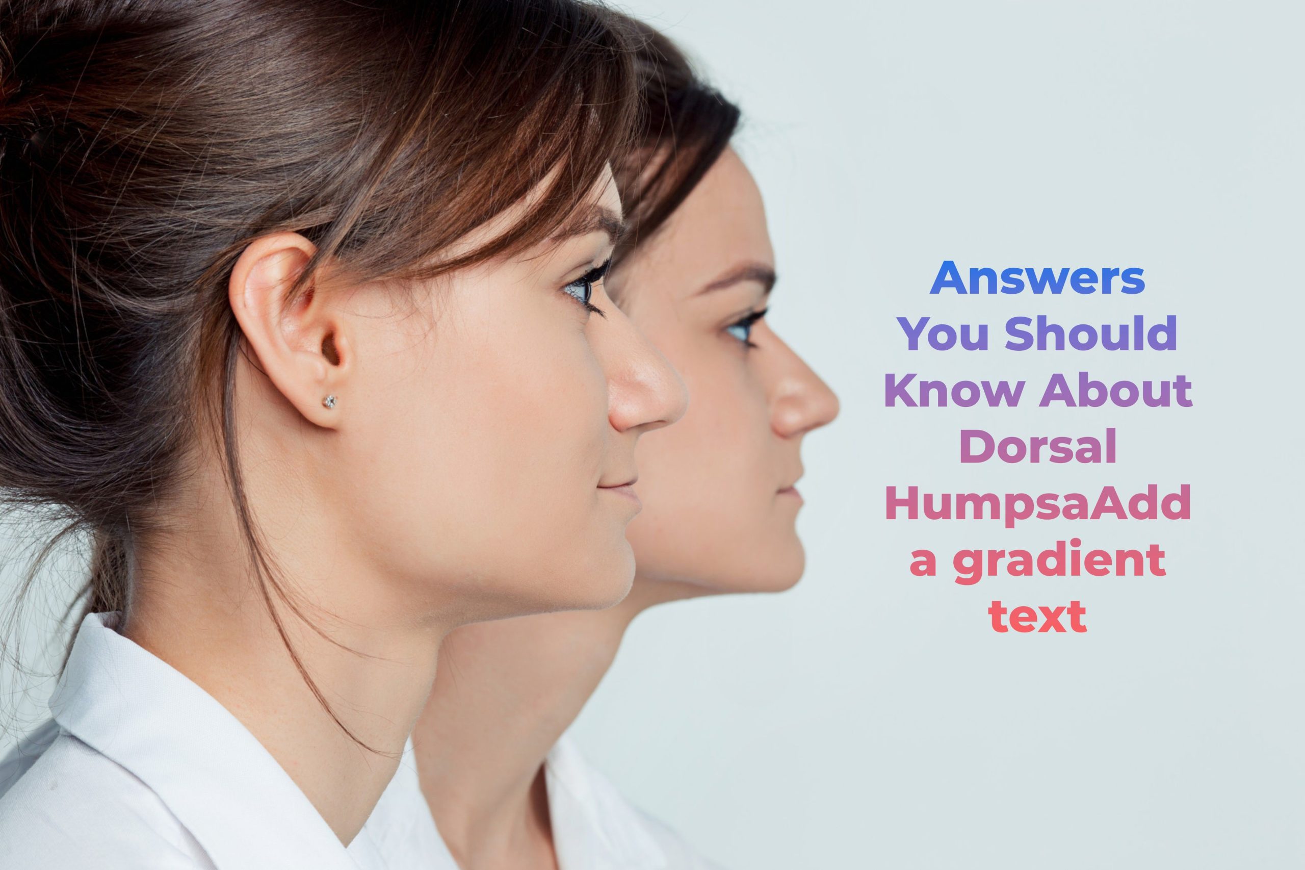 Answers You Should Know About Dorsal Humps
