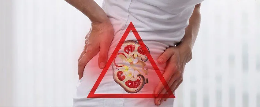 Kidney Stone Doctor in Jaipur